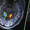 image of a coronal brain slice in an fMRI machine